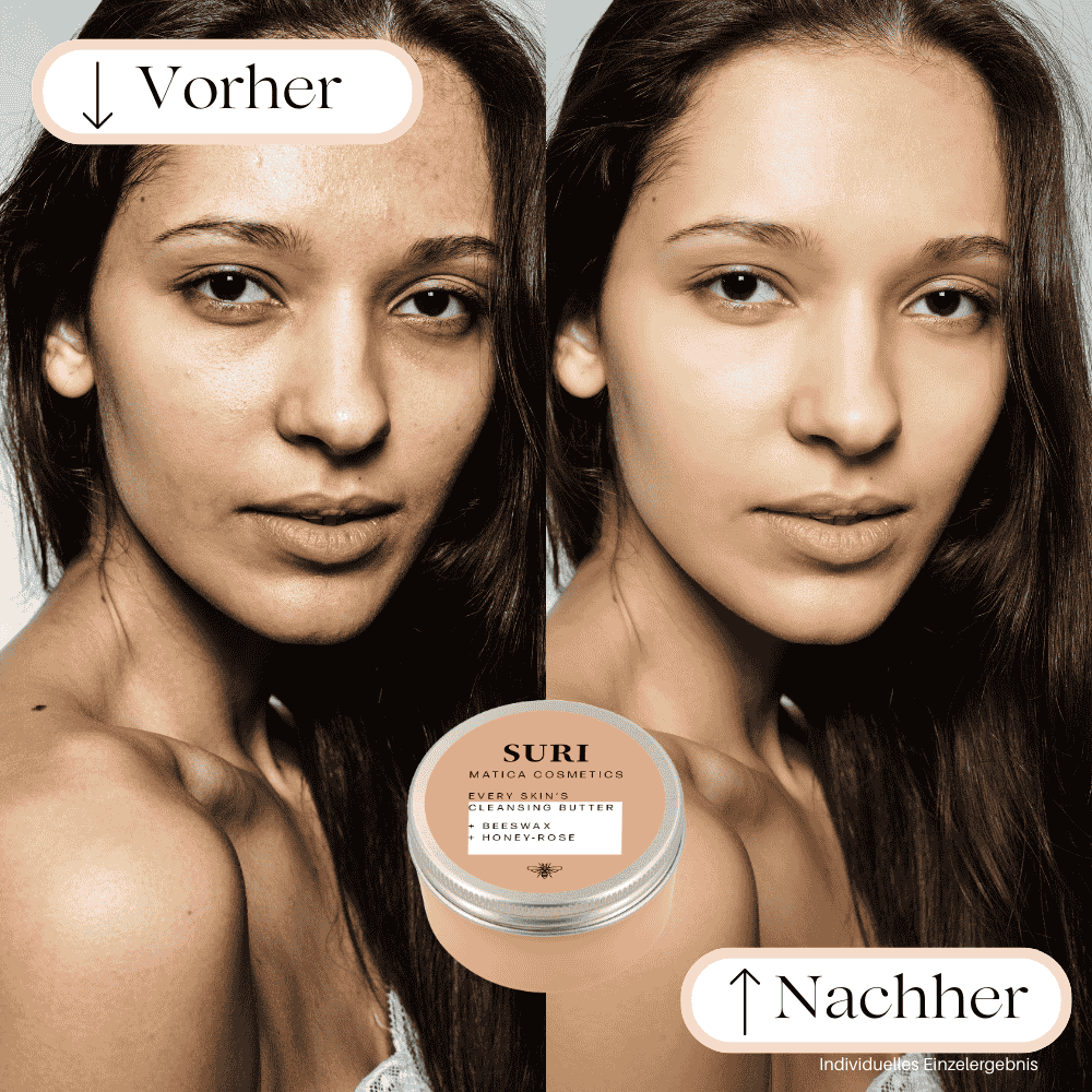 Vorher: Die Haut ist mit Make-up, Schmutz und überschüssigem Talg bedeckt, fühlt sich möglicherweise trocken oder gereizt an.
Nachher: Die Haut ist gründlich gereinigt, weich, gut mit Feuchtigkeit versorgt und erhält einen natürlichen Glow ohne Trockenheit oder Spannungsgefühl.