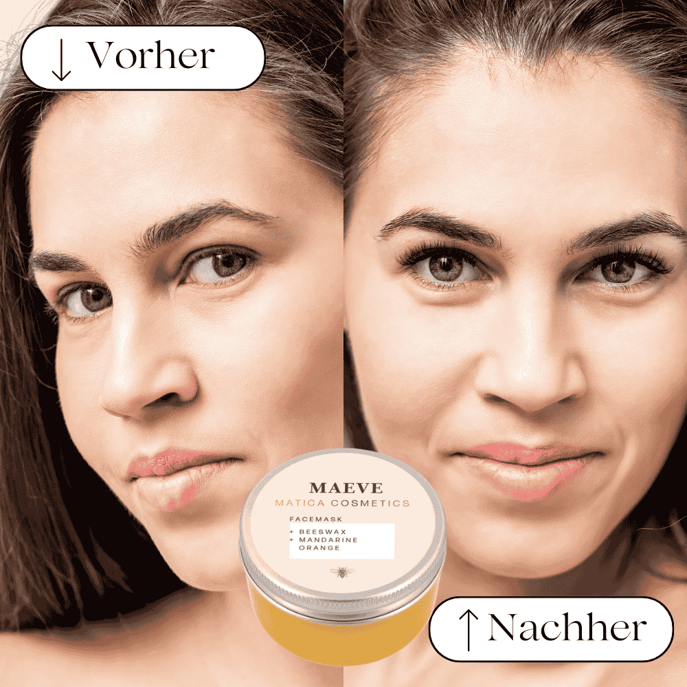 Vorher: Die Haut fühlt sich trocken an und zeigt Unreinheiten oder sichtbare Poren.
Nachher: Die Haut ist erfrischt, strahlend, intensiv mit Feuchtigkeit versorgt und hat eine glatte, seidige Textur.