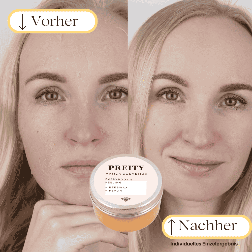 Vorher: Die Haut fühlt sich rau an, hat trockene Stellen und Unreinheiten.
Nachher: Die Haut ist weich, gut durchfeuchtet, und das Hautbild ist verfeinert und strahlt.