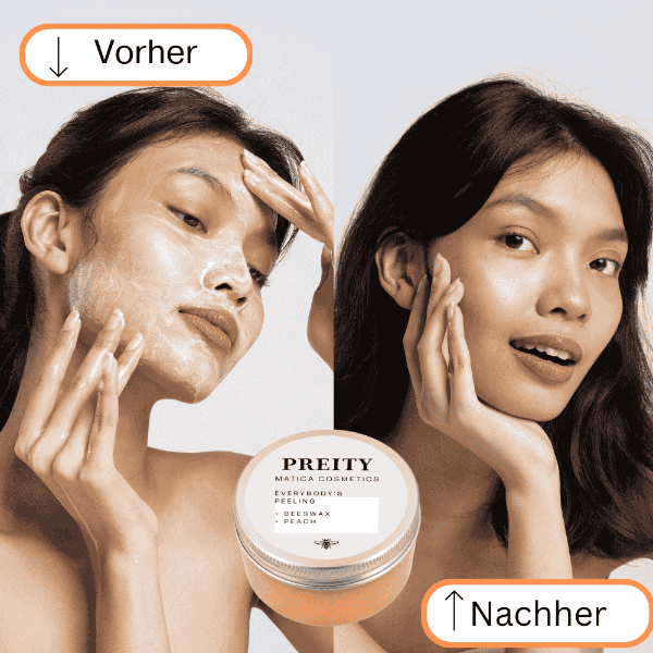 Vorher: Die Haut wirkt unrein, trocken und ungleichmäßig.
Nachher: Die Haut ist glatt, feuchtigkeitsversorgt und zeigt ein klares, gepflegtes Hautbild mit einem strahlenden Teint.