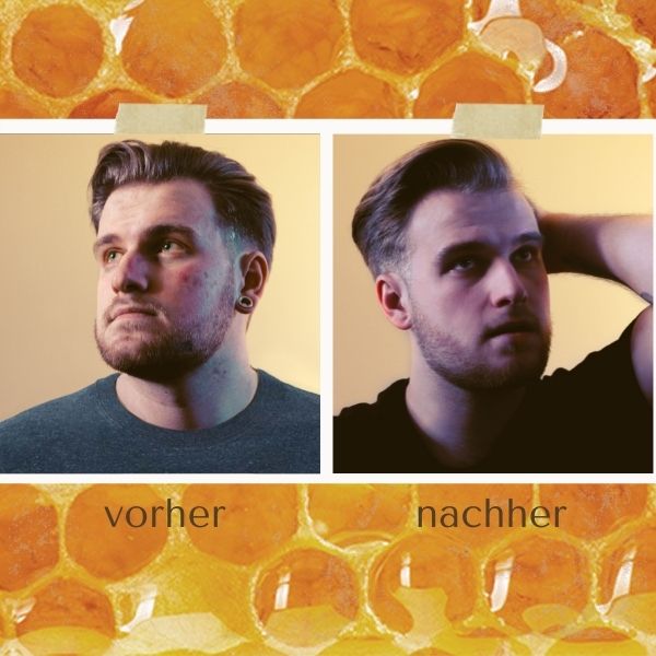 Matica Cosmetics Naturkosmetik aus Hamburg Trut Vorher / Nachher Matica Cosmetics