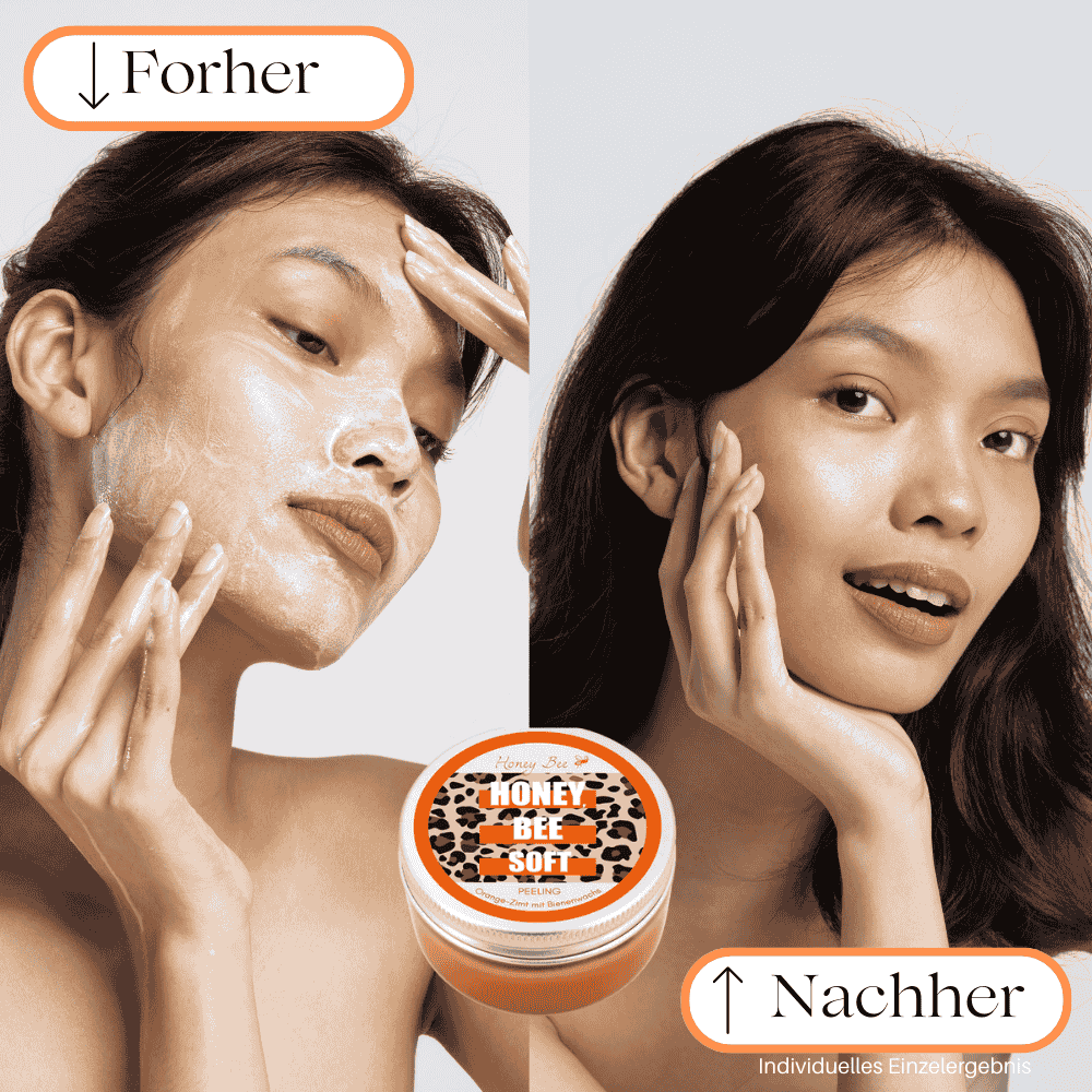 Vorher: Die Haut wirkt unrein, trocken und ungleichmäßig.
Nachher: Die Haut ist glatt, feuchtigkeitsversorgt und zeigt ein klares, gepflegtes Hautbild mit einem strahlenden Teint.